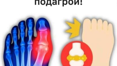 Топ-5 напитков, которые помогают снизить уровень мочевой кислоты и облегчить подагру. Топ-5 напитков, которые помогают снизить уровень мочевой кислоты и облегчить подагру.